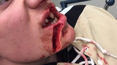 Škaredé zranenie hokejistu! Aj takto môže dopadnúť oslava