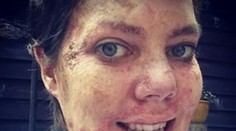 Bola márnivá a zakladala si na výzore. Po tragédii tvrdí, že je lepší človek