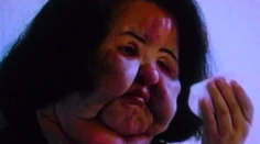Tvár ako zombie. Aj toto spôsobujú fejkové prípravky