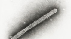 WHO potvrdila prvý smrteľný prípad vtáčej chrípky H5N2 u človeka