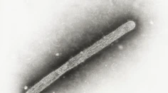 WHO potvrdila prvý smrteľný prípad vtáčej chrípky H5N2 u človeka