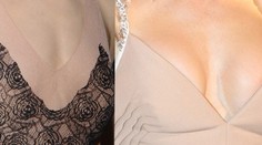Vynikajúca práca chirurga. Nicole Kidman a jej nenápadné silikóny