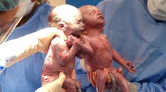 Narodili sa a hneď sa držali za ruky. Takto vyzerajú malé hviezdy internetu dnes