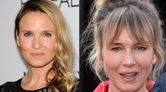 Vykašľala sa na botox! Renee Zellweger sa začína na seba podobať
