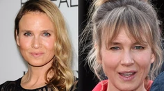 Vykašľala sa na botox! Renee Zellweger sa začína na seba podobať