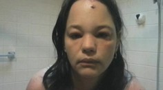 Šokujúce video: Mačka brutálne napadla majiteľku