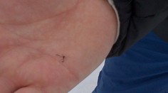 FOTO: Na lyžiarskom svahu v Levoči sa objavili komáre