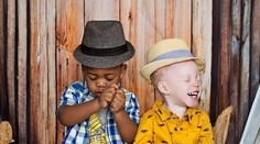 Narodili sa jej dvojičky, každé s inou farbu pleti. Myslela si, že jej deti v nemocnici vymenili