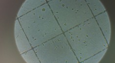 Dvadsaťroční majú horšie spermie, než 40-roční muži