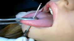 Pozrite si, aké riziká prináša piercing