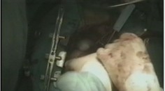 Ubehlo už štvrťstoročie. Pozrite si autentické zábery prvej transplantácie srdca na Slovensku