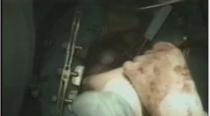 Ubehlo už štvrťstoročie. Pozrite si autentické zábery prvej transplantácie srdca na Slovensku