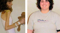 Neuveriteľné premeny jednej ženy. Najskôr anorexia, potom obezita a teraz...