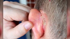 Za toto ochorenie sa stále hanbíme. Trpia ním pritom dve percentá Slovákov