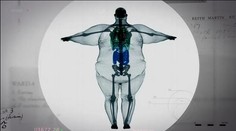 Ako vyzerá 400-kilový muž pod röntgenom? Pozrite sa na ten kontrast
