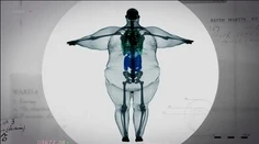 Ako vyzerá 400-kilový muž pod röntgenom? Pozrite sa na ten kontrast