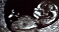 Žiari šťastím. Po dvoch adopciách nosí herečka pod srdcom dieťa