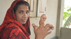 Žene narástla obria ruka. Lekári sú bezradní