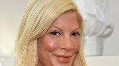 Otrasná tvár hviezdy Beverly Hills 902 10 vás šokuje