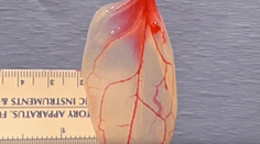 Vedci vytvorili srdcové tkanivo zo špenátu. Hovoria o revolúcii v medicíne