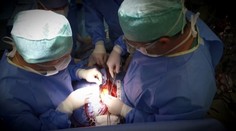 Vo Viedni vykonali prvú transplantáciu pľúc pacientovi s koronavírusom