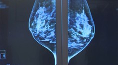 Čím neskôr žena prvýkrát rodí, tým vyššie je riziko rakoviny