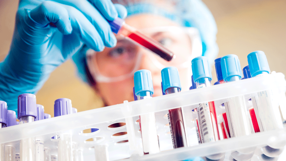 V stredu pribudli ďalšie desiatky nakazených, máme vyše tisíc aktívnych prípadov