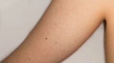 Máte takéto červené bodky na rukách? Vieme, čo znamenajú