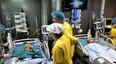 Už aj druhé z oddelených siamských dvojčiat v Bangladéši sa prebralo