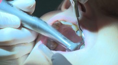 Pre zubárkin podvod jej poisťovňa nepreplatila korunku. Pani Oľga tak prišla o 100 eur