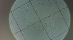 Počet párov, ktoré majú problém otehotnieť, sa stále zvyšuje