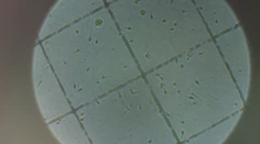 Počet párov, ktoré majú problém otehotnieť, sa stále zvyšuje