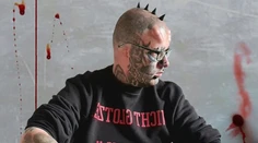 Muž si dal odstrániť uši. Chcel, aby jeho hlava vyzerala ako lebka