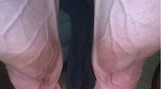 Fotka, ktorá spôsobila mediálnu búrku. Nohy cyklistu po Tour de France