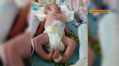 Narodil sa s konskou nožičkou. Má za sebou náročnú operáciu, potrebuje aj ďalšiu