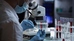 Nový výskum o šírení covidu. Za veľmi krátky čas stratí až 90 percent schopnosti infikovať ľudí