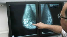 Možný prelom v liečbe rozšíreného druhu rakoviny. Vedci sa vo výskume posunuli vpred