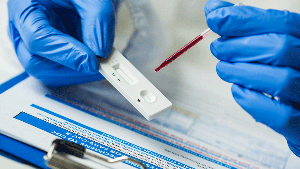 V pondelok pribudli dva prípady ochorenia COVID-19