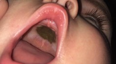 Matku vystrašila záhadná čierna škvrna v ústach dcéry. Keď zistila, o čo ide, musela sa smiať