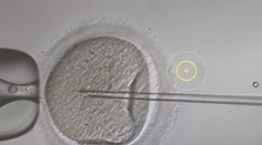 Dávajú nádej párom, ktoré majú problém počať dieťa. Ako vyzerá proces darovania vajíčok?