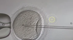 Dávajú nádej párom, ktoré majú problém počať dieťa. Ako vyzerá proces darovania vajíčok?