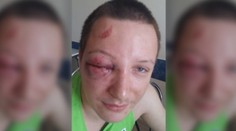 Napomenul dieťa na detskom ihrisku, takúto bitku za to dostal od jeho rodičov