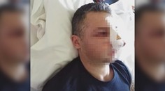 Na Nový rok brutálne dobili hasiča, tínedžer (17) sa priznal rodičom