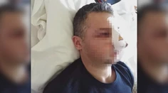 Na Nový rok brutálne dobili hasiča, tínedžer (17) sa priznal rodičom