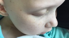 Krutý boj s rakovinou. Fotka poslednej mihalnice vysíleného dievčatka dojala tisíce ľudí