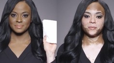 Žena odhalila svoju pravú tvár. Každý je krásny taký, aký je!