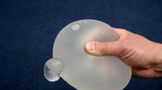 Žene zachránil život silikónový implantát, ktorý odklonil projektil mieriaci do srdca