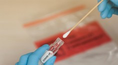 Pribudlo 18 prípadov, ide o najvyšší prírastok nakazených za posledné dva mesiace