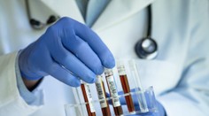 Vedci skúmali krv ľudí, ktorí sa dožili 100 rokov. Zistili, že všetci majú niečo spoločné