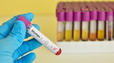 V prešovskom kraji sa šíri mumps, žltačka aj salmonelóza